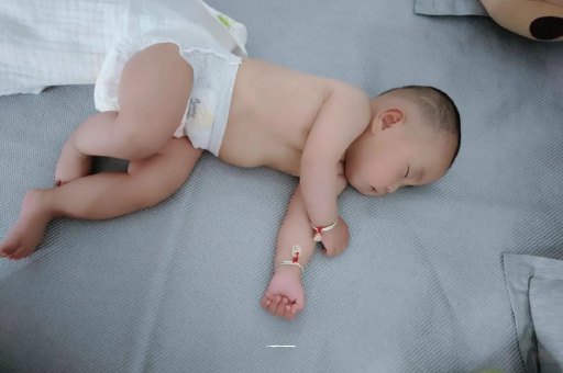 沈丘六个月宝宝眼睛散光